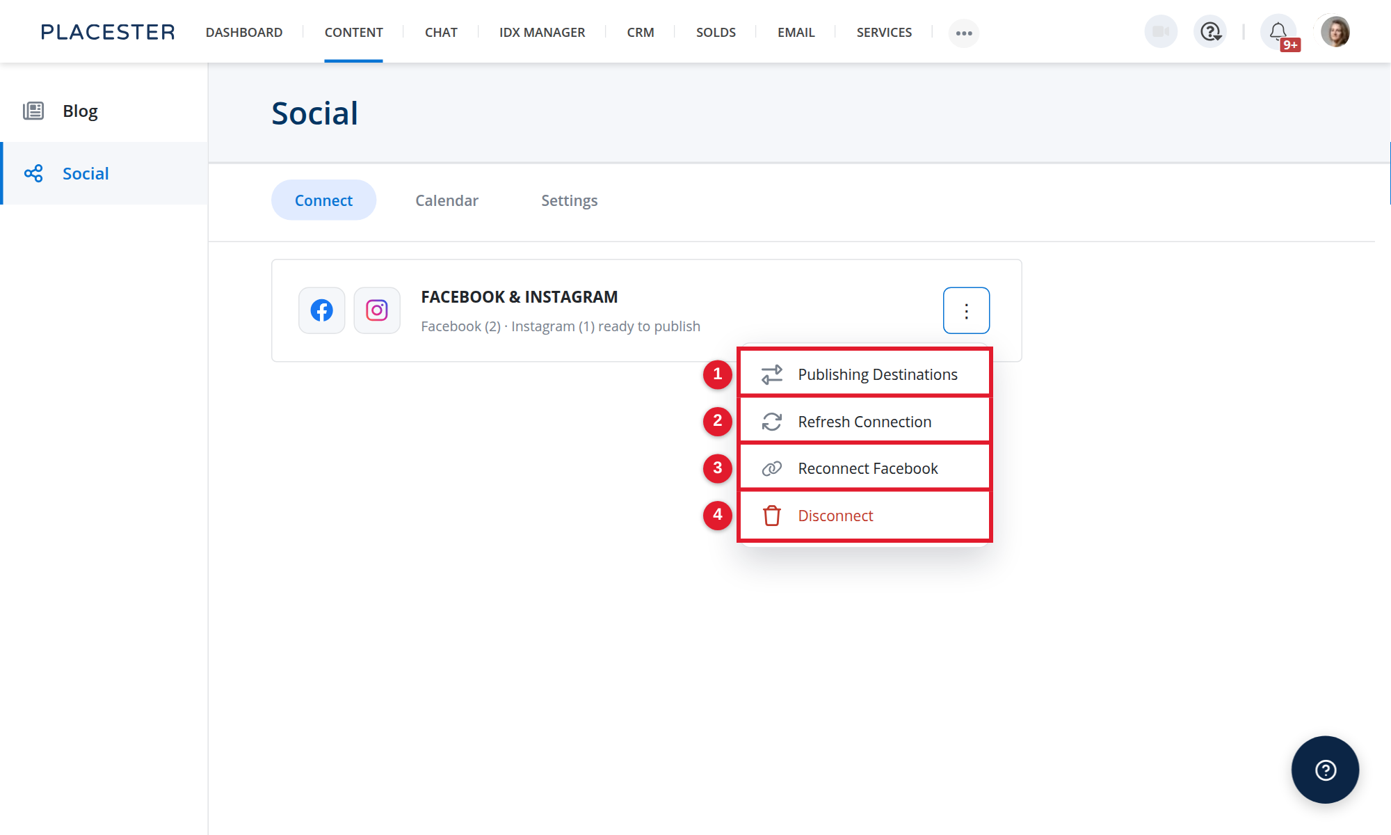 Connection management options